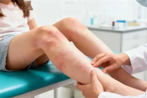 详细介绍