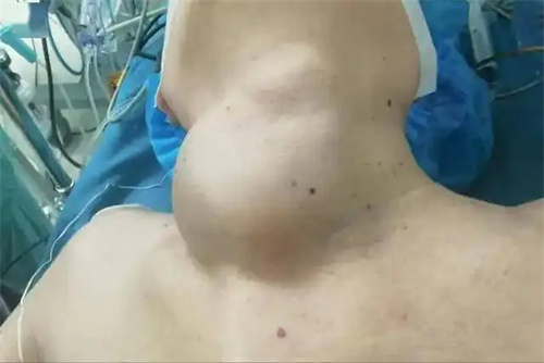 细节介绍