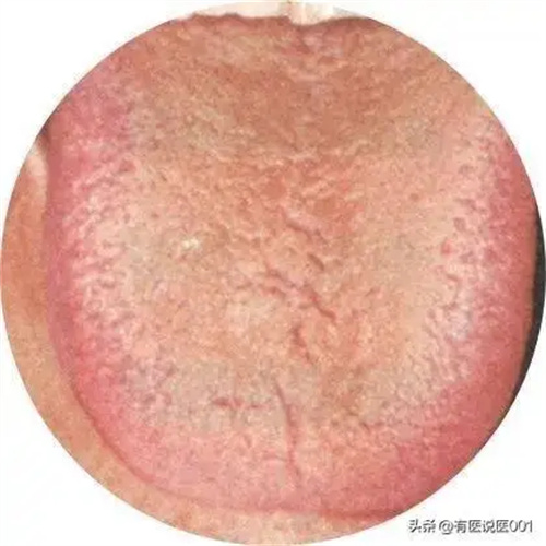 细节呈现