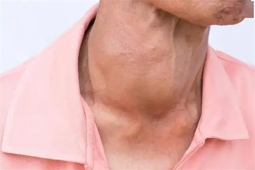 细节介绍