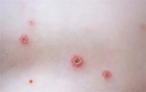 细节介绍