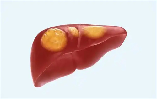 细节介绍