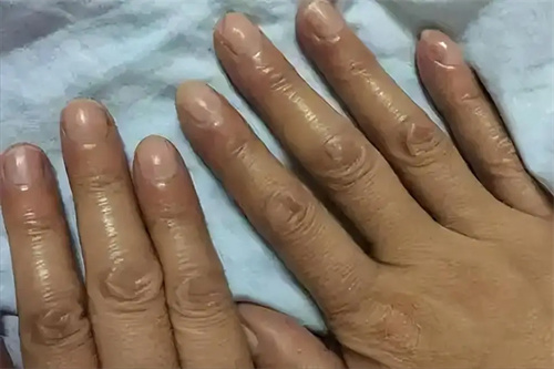 详细说明