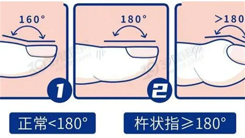 细节呈现