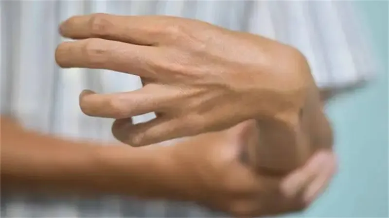 详细介绍