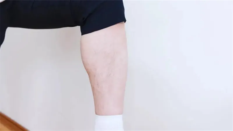 细节介绍
